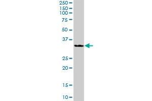 HSD11B1 MaxPab polyclonal antibody. (HSD11B1 抗体  (AA 1-292))