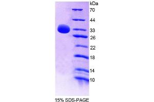 SDS-PAGE analysis of Human PTPN7 Protein. (PTPN7 蛋白)