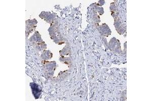Immunohistochemical staining of human fallopian tube with DNAH6 polyclonal antibody  shows strong membranous positivity in glandular cells. (DNAH6 抗体)