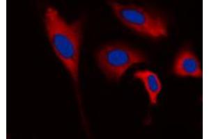 Immunofluorescent analysis of INPP5J staining in HEK293T cells. (INPP5J 抗体  (C-Term))