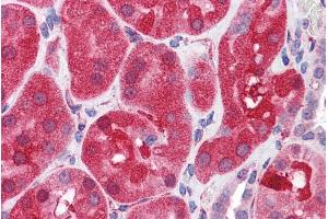 Immunohistochemistry (IHC) image for anti-Protein tyrosine Phosphatase, Non-Receptor Type 11 (PTPN11) (C-Term) antibody (ABIN184604)