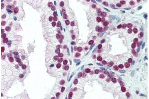 Human Prostate (formalin-fixed, paraffin-embedded) stained with NKX3-1 antibody ABIN462123 followed by biotinylated anti-mouse IgG secondary antibody ABIN481714, alkaline phosphatase-streptavidin and chromogen. (NKX3-1 抗体  (N-Term))