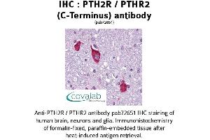 Image no. 1 for anti-Parathyroid Hormone 2 Receptor (PTH2R) (C-Term), (pThr2) antibody (ABIN1738583) (PTH2R 抗体  (C-Term, pThr2))