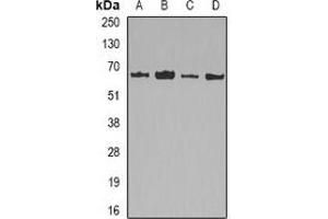 Western blot analysis of Lamin B2 expression in HepG2 (A), MCF7 (B), mouse liver (C), mouse heart (D) whole cell lysates. (Lamin B2 抗体)