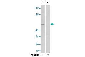 Western blot analysis of extracts from HeLa cells, using ADRB2 polyclonal antibody . (beta 2 Adrenergic Receptor 抗体  (C-Term))