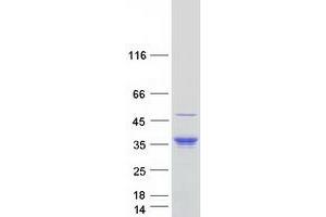Western Blotting (WB) image for Endoplasmic Reticulum Protein 27 (ERP27) protein (Myc-DYKDDDDK Tag) (ABIN2720505)