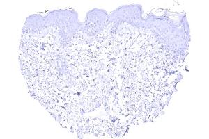 Absence of KRT13 staining in the keratinizing squamous epithelium of the skin (Cytokeratin 13 抗体)