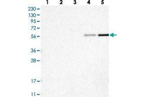 Western blot analysis of Lane 1: RT-4, Lane 2: U-251 MG, Lane 3: Human Plasma, Lane 4: Liver, Lane 5: Tonsil with RMND1 polyclonal antibody . (RMND1 抗体)