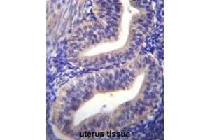TBPL2 Antibody (N-term) immunohistochemistry analysis in formalin fixed and paraffin embedded human uterus tissue followed by peroxidase conjugation of the secondary antibody and DAB staining. (Tbpl2 抗体  (N-Term))