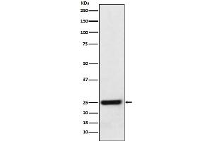 Western blot analysis of ERAB expression in HeLa cell lysate.
