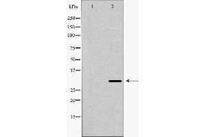 Western blot analysis of Mouse liver tissue lysates, using DCN Antibody. (Decorin 抗体  (Internal Region))
