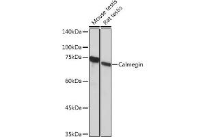 Western blot analysis of extracts of various cell lines, using Calmegin Rabbit mAb (ABIN7266026) at 1:1000 dilution. (Calmegin 抗体)