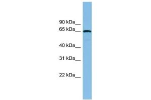WB Suggested Anti-RAD18 Antibody Titration: 0. (RAD18 抗体  (Middle Region))