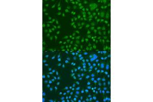 Immunofluorescence analysis of U2OS cells using KAT5 antibody. (KAT5 抗体  (AA 1-230))