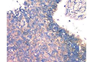 IHC analysis of FH using anti-FH antibody (ABIN7603168).