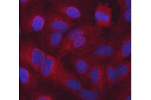 IF analysis of Seryl-TRNA Synthetase/SERS/SARS1 using anti-Seryl-TRNA Synthetase/SERS/SARS1 antibody (ABIN7602365). (Seryl-tRNA Synthetase (SARS) (AA 71-483) 抗体)