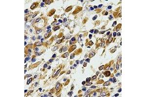 Immunohistochemical analysis of Glutaredoxin staining in human stomach formalin fixed paraffin embedded tissue section. (Glutaredoxin 1 抗体)