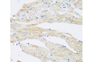 Immunohistochemistry of paraffin-embedded Mouse heart using NAT8B Polyclonal Antibody at dilution of 1:200 (40x lens). (NAT8B 抗体)