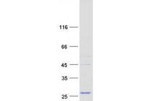 Western Blotting (WB) image for Intraflagellar Transport 27 Homolog (IFT27) protein (Myc-DYKDDDDK Tag) (ABIN2712356)