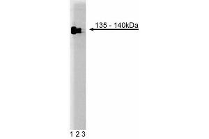 Western blot analysis of TFII-I on HeLa cell lysate. (GTF2I 抗体  (AA 17-123))