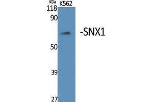 Western Blotting (WB) image for anti-Sorting Nexin 1 (SNX1) (Internal Region) antibody (ABIN3177459) (Sorting Nexin 1 抗体  (Internal Region))