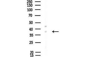 anti-ELOVL Fatty Acid Elongase 2 (ELOVL2) (N-Term) antibody