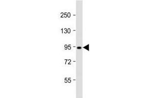 Western blot testing of Dnmt3b antibody at 1:2000 dilution + T47D lysate; Predicted molecular weight: 95 kDa. (DNMT3B 抗体  (AA 389-417))