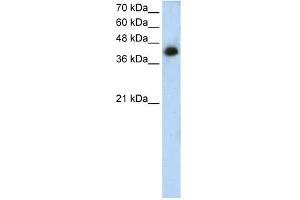 WB Suggested Anti-MTUS1 Antibody Titration: 1. (MTUS1 抗体  (N-Term))