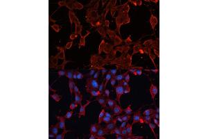 Immunofluorescence (IF) image for anti-ADAM Metallopeptidase Domain 12 (ADAM12) (AA 589-738) antibody (ABIN6136521)