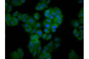 Immunofluorescence staining of HepG2 cells with ABIN7152402 at 1:166, counter-stained with DAPI. (Cyclin F 抗体  (AA 248-400))