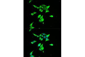 Immunofluorescence analysis of A549 cells using CD55 antibody (ABIN5970570). (CD55 抗体)