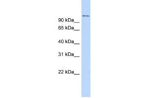 WB Suggested Anti-RBBP8 Antibody Titration:  0. (Retinoblastoma Binding Protein 8 抗体  (C-Term))