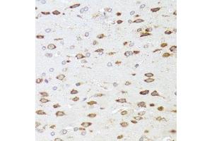Immunohistochemistry of paraffin-embedded rat brain using ARHGAP5 antibody. (ARHGAP5 抗体  (AA 1292-1501))