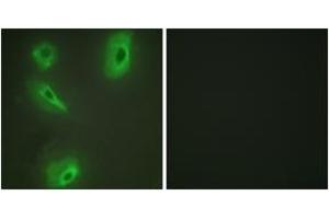 Immunofluorescence (IF) image for anti-Branched Chain Ketoacid Dehydrogenase Kinase (BCKDK) (AA 11-60) antibody (ABIN2889312) (BCKDK 抗体  (AA 11-60))