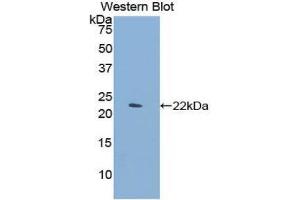Western Blotting (WB) image for anti-C-Type Lectin Domain Family 4, Member M (CLEC4M) (AA 242-399) antibody (ABIN1858422) (C-Type Lectin Domain Family 4, Member M (CLEC4M) (AA 242-399) 抗体)