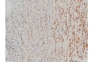 Immunohistochemistry (IHC) image for anti-Cofilin 1 (CFL1) (pSer3) antibody (ABIN6255180)
