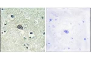 Immunohistochemistry analysis of paraffin-embedded human brain, using NMDAR1 (Phospho-Ser890) Antibody. (GRIN1/NMDAR1 抗体  (pSer890))