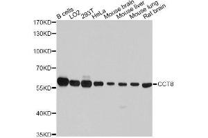 Western blot analysis of extracts of various cell lines, using CCT8 antibody. (CCT8 抗体  (AA 248-497))