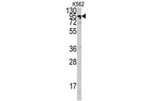 Western blot analysis of ACE2 polyclonal antibody  in K-562 cell lysate (35 ug/lane). (ACE2 抗体  (AA 773-805))