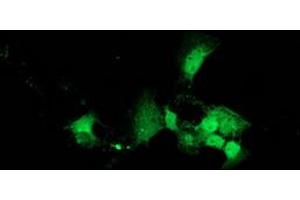 Image no. 1 for anti-DnaJ (Hsp40) Homolog, Subfamily B, Member 2 (DNAJB2) antibody (ABIN1497868) (DNAJB2 抗体)