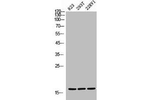 Western Blot analysis of 823 293T 22RV cells using CD235a Polyclonal Antibody (CD235a/GYPA 抗体  (Internal Region))
