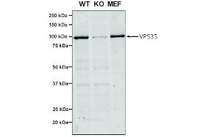 Western Blot analysis of Human, Mouse A549, MEF showing detection of VPS35 protein using Mouse Anti-VPS35 Monoclonal Antibody, Clone 7E4 (ABIN6932908).
