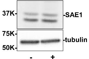 Western blot using  Rabbit anti-SAE1 antibody shows detection of SAE1. (SAE1 抗体  (Internal Region))