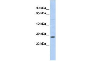 RAB38 antibody used at 1 ug/ml to detect target protein. (RAB38 抗体  (N-Term))