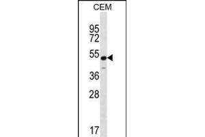 Western Blotting (WB) image for anti-Potassium Inwardly-Rectifying Channel, Subfamily J, Member 8 (KCNJ8) (AA 4-33), (N-Term) antibody (ABIN656236)