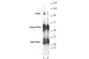 CHD3 antibody (rAb) tested antibody tested by immunoprecipitation. (Recombinant CHD3 抗体  (AA 865-885))