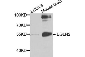 Western blot analysis of extracts of various cell lines, using EGLN2 antibody (ABIN5971259) at 1/1000 dilution. (PHD1 抗体)