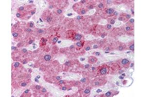 Immunohistochemistry (IHC) image for anti-Hepatocyte Growth Factor (Hepapoietin A, Scatter Factor) (HGF) (N-Term) antibody (ABIN2781817) (HGF 抗体  (N-Term))
