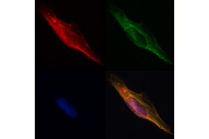 ABIN6261605 and ABIN6268755 staining Hela by IF/ICC. (EpCAM 抗体  (Internal Region))