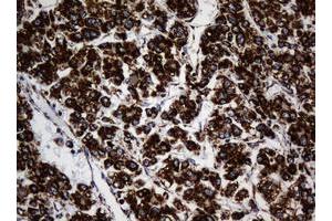 Image no. 3 for anti-NADH Dehydrogenase (Ubiquinone) 1 beta Subcomplex, 10, 22kDa (NDUFB10) antibody (ABIN1499672) (NDUFB10 抗体)